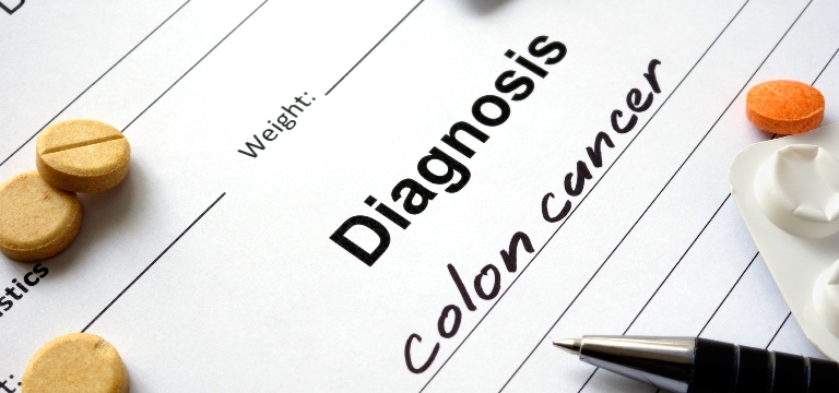 colon-cancer-diagnosis
